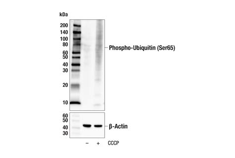 Phospho